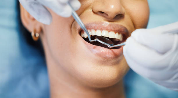 Best Emergency Wisdom Teeth Removal in Pitman, NJ